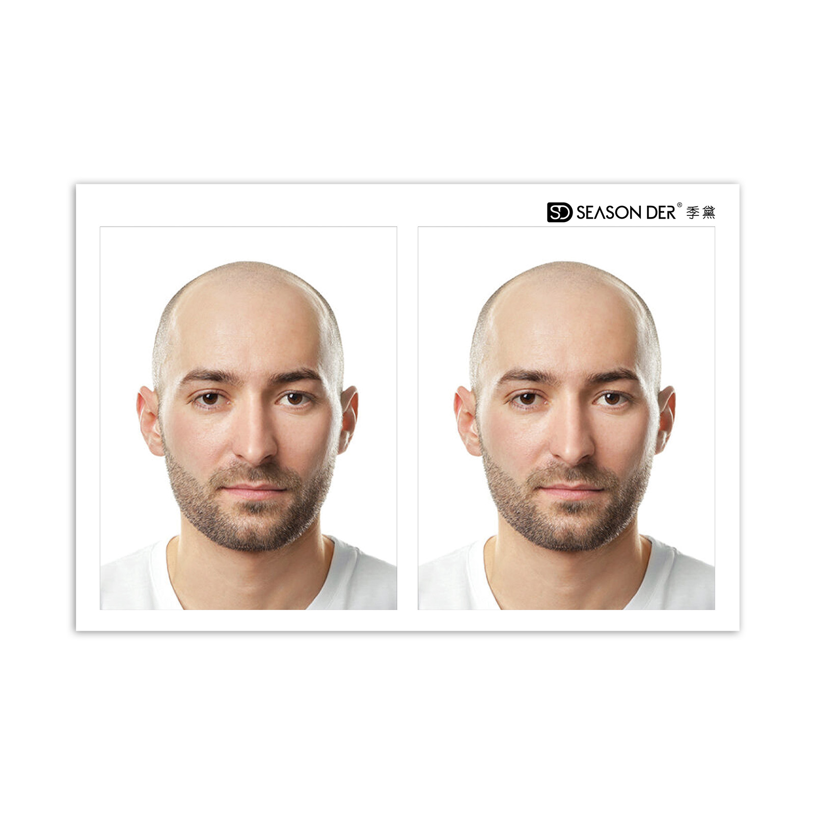 Bald head Pattern