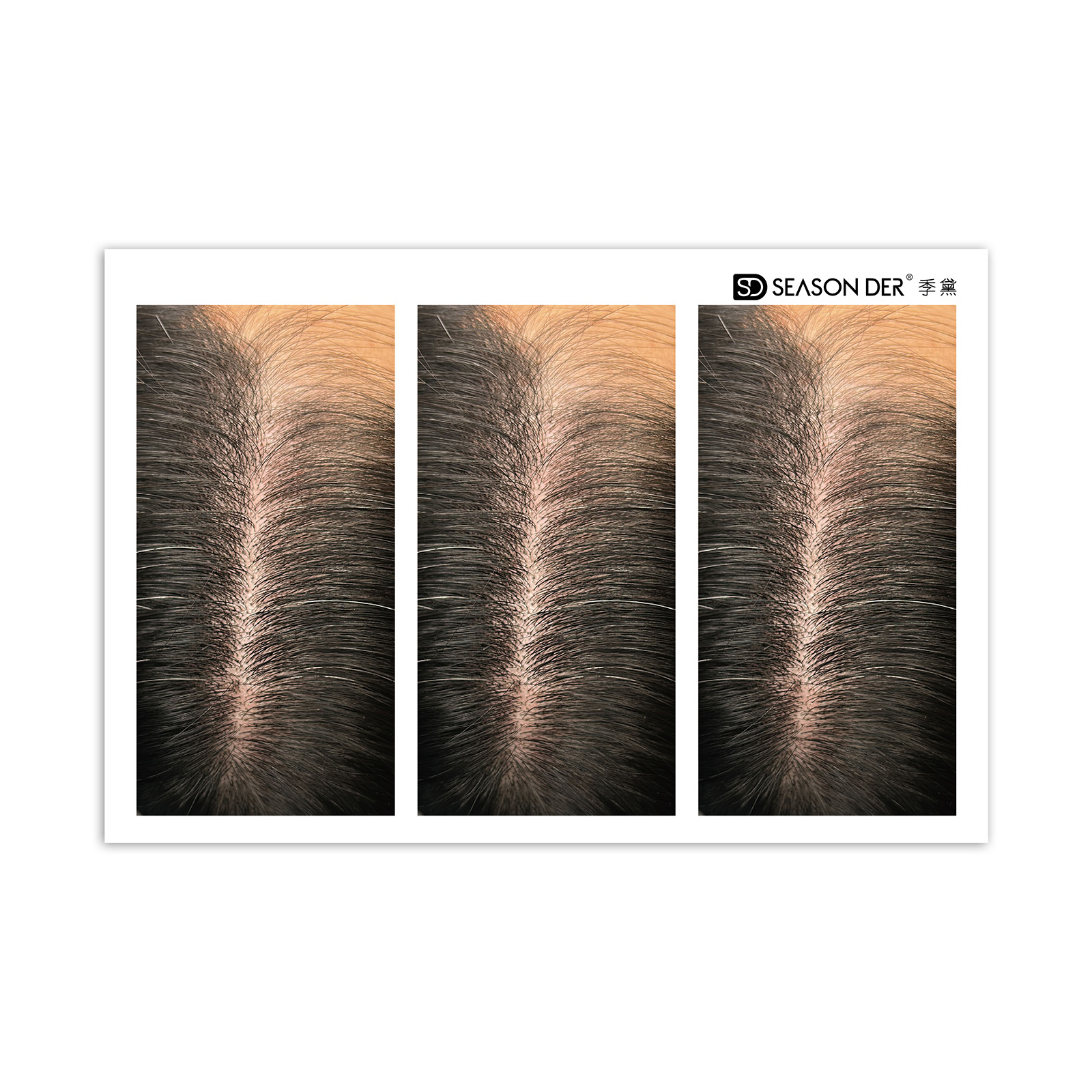 Hair parting  Pattern